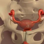 Love, sex and hysterectomy