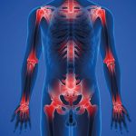 Stealthy Inflammation