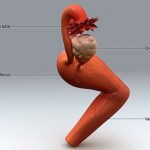 Vagina rejuvenation now includes treating medical issues