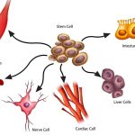 What is regenerative medicine, what are its benefits, and is it for you?