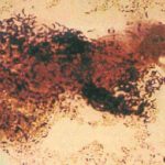 This helpful bacterium can also be responsible for vaginal infections