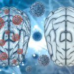 Not just brain fog: Covid-19 could have other serious effects on our brain