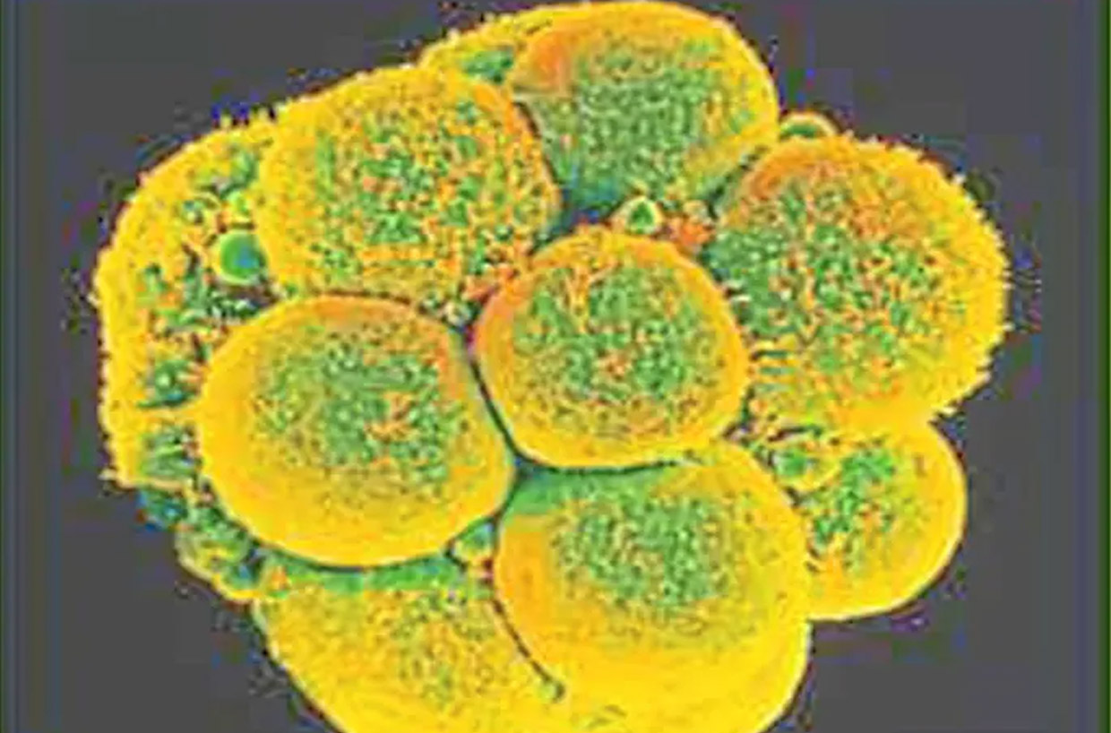 Read more about the article Targeting cancer via its unique metabolism