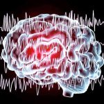 Taking a functional approach to managing epilepsy